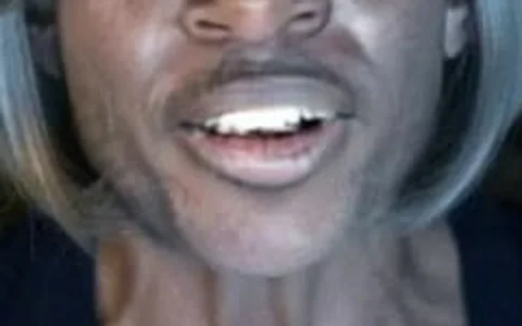 Close-up of a video frame where the swapped face is darker than the neck below it and the teeth are smeared